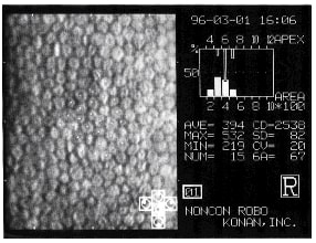 Konan Corneal Endothelial Cell Counter