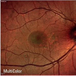 Topcon Imagenet Retinal Digital Imaging System