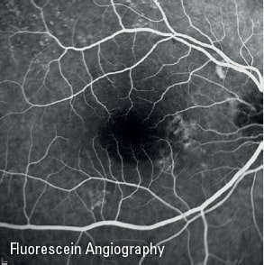 Topcon Imagenet Retinal Digital Imaging System