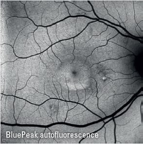 Topcon Imagenet Retinal Digital Imaging System