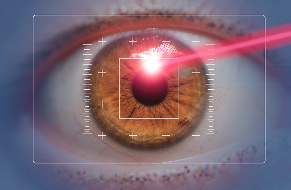 Refractive Eye Surgery Options Beyond LASIK