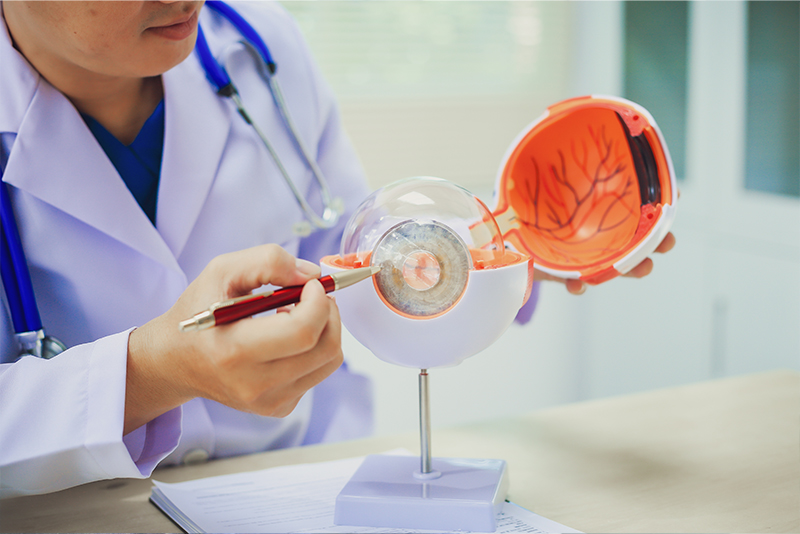 Glaucoma: Why It Is Known as the “Silent Thief of Sight”